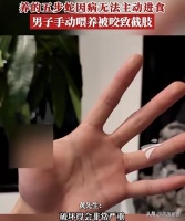 茶盏留香：猎奇的代价：当宠物逾越安全边界
北京一名男子养蛇当宠物，手动喂食时被咬，最终截肢。
北京男子饲养五步蛇被咬截肢事件，为危险宠物饲养乱象敲响血色警钟。
首先，个人严重漠视自然风险。五步蛇是剧毒蛇类，饲养它需具备极高专业知识与严格防护条件。将致命野生动物“宠物化”，是猎奇心理战胜理性认知的危险之举。手动喂食病蛇，无异于将自己推向死亡边缘。
其次，法律监管存在显著漏洞。我国对危险动物饲养缺少分...