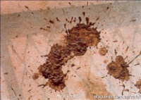 如何判断宠物便便是否正常？