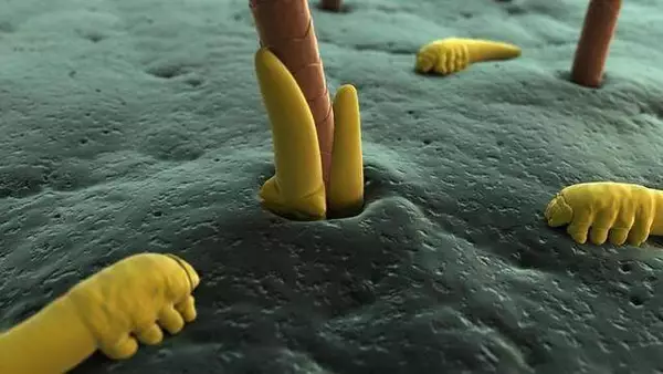 kills-demodex-mites_e3aace52d96a6dcc.jpg